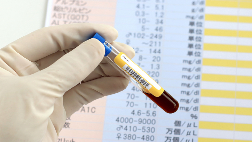 典型的な結果と非典型的な結果